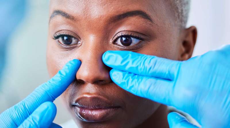 What Concerns Can Non-Surgical Rhinoplasty Treat?